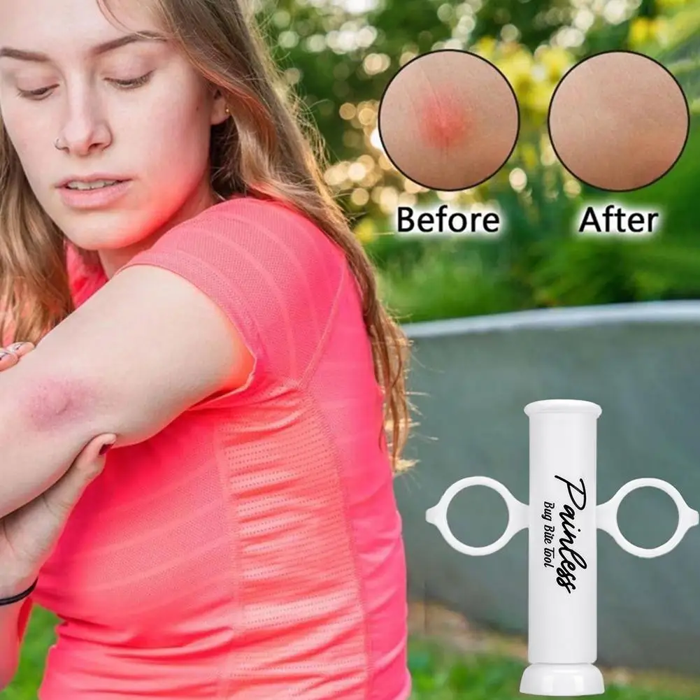 Bug Bite Suction Tool Venom Ex - огляд і ціна Field Dressing Kit